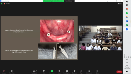 Dua Mahasiswa PPDGS FKG UNAIR Tampil Memukau dalam Sharing Prosthodontic Case Discussions dengan Bharati Vidyapeeth (BVDU), India